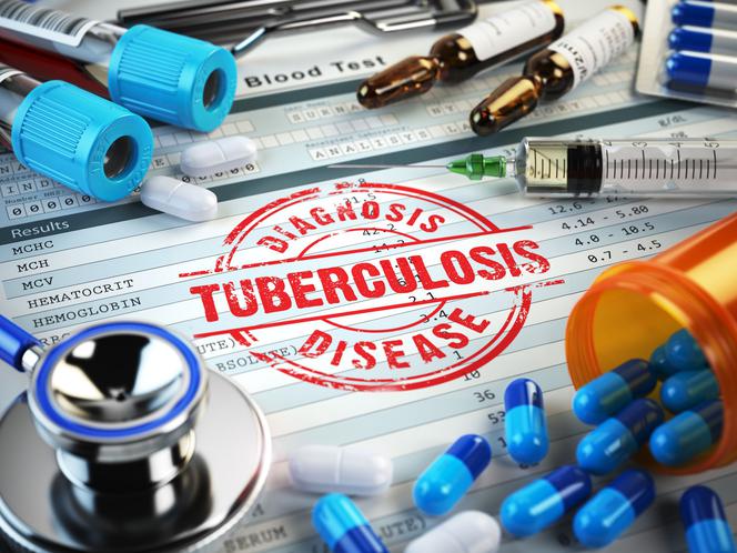 Próba tuberkulinowa - badanie diagnozujące gruźlicę