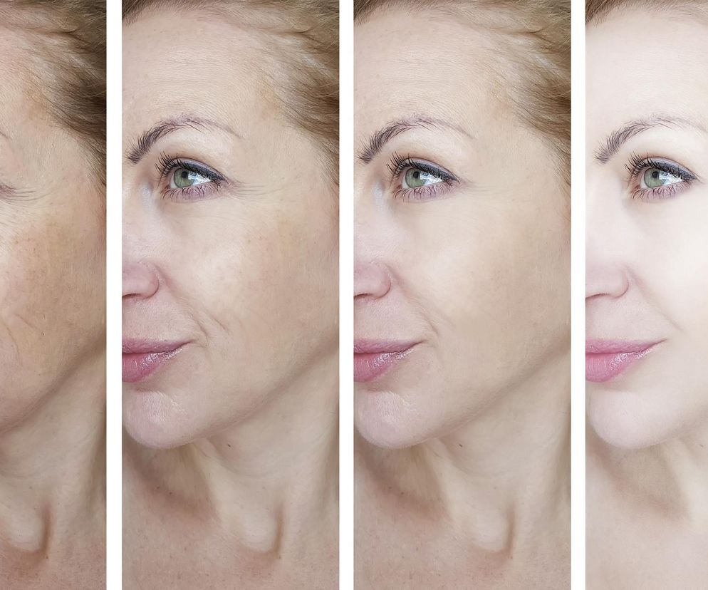 Kosztuje 13 zł, a ujędrnia skórę lepiej niż masaż kobido. Pozbądź się zmarszczek raz-dwa