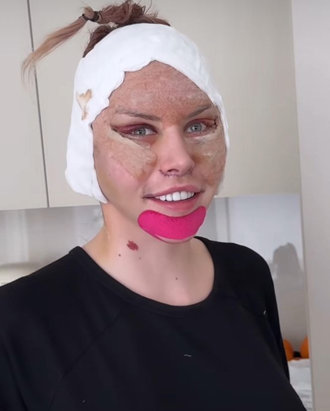 Julia Von Stein po operacji 