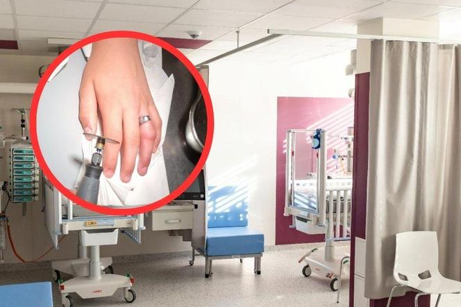 Śląskie: Nastolatek założył obrączkę na palec. Strażacy musieli użyć piły
