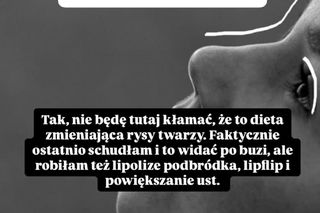 Natalia Zambrzycka (Agata z serialu Barwy szczęścia) na Instagramie przyznała się, co zrobiła z twarzą! 