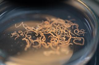 Organizm daje znać, że zmaga się z pasożytami? Te badania ujawnią, jak jest naprawdę