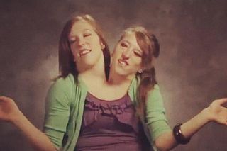 Siostry syjamskie urodziły dziecko?! Sensacyjne doniesienia