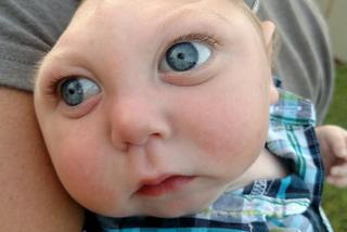 To dziecko ma pół głowy i żyje! Ciężko chory Jaxon wygrał walkę o życie