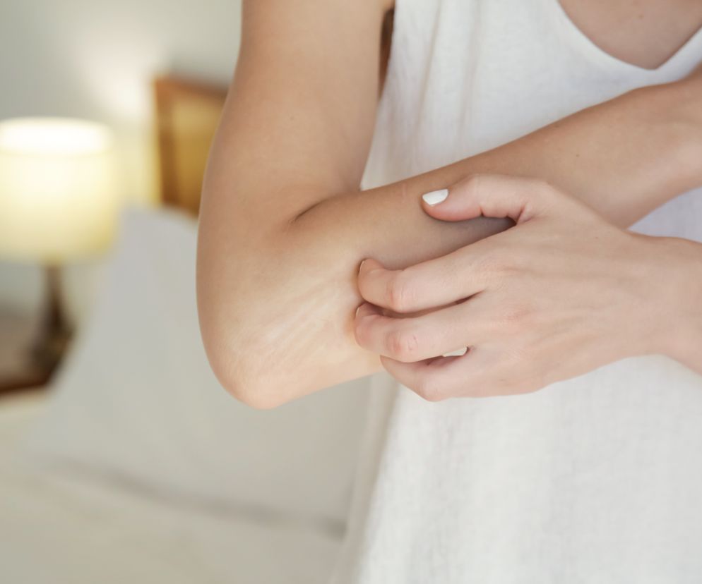 choroby nerek, które widać na skórze