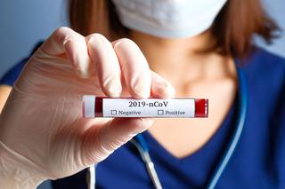 Testy na koronawirusa made in China wadliwe?