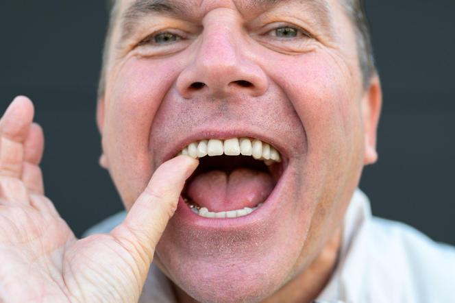 Lek na odrastanie zębów? Przełomowe badania wkraczają w kolejny etap