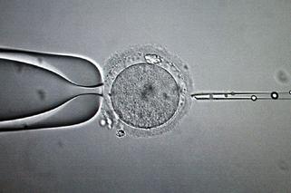 Sztuczne zapłodnienie, in vitro, plemniki