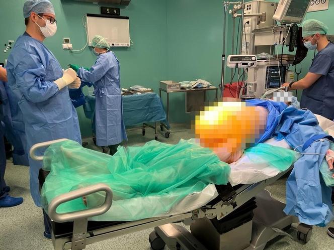 Lekarze ze szpitala Latawiec usunęli gigantycznego guza 38-letniej pacjentce