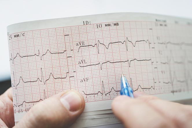 Wykres EKG serca 