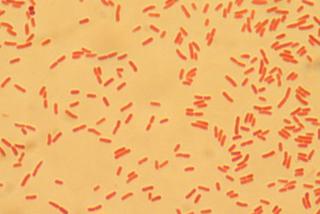 Bakteria E.coli wybarwiona