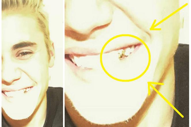Justin Bieber złoty ząb