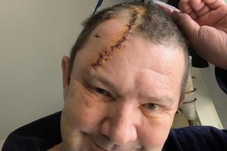 Sławek mógł zginąć przez psią kupę. Gmina tłumaczy się z kuriozalnego znaku