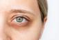 Patofizjonomika, czyli czytanie choroby z twarzy. Czy mapki z wypisanymi schorzeniami są prawdziwe?