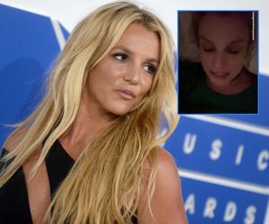 Britney Spears spaliła sobie twarz! Wypadek gwiazdy przy kominku