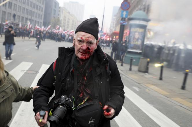 Tomasza Gutry, fotograf postrzelony na Marszu Niepodległości