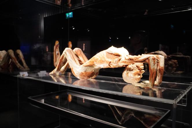 Wystawa z ludzkiego ciała. Body Worlds powróciła do Gdańska po 5 latach 