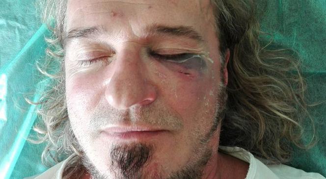 Miał wystąpić na Woodstocku. Został brutalnie pobity
