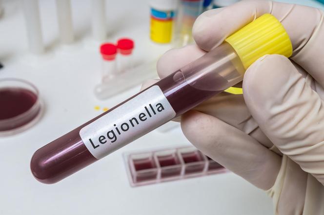 Legionella sieje postrach nie tylko w Polsce. Eksperci wskazują przyczynę