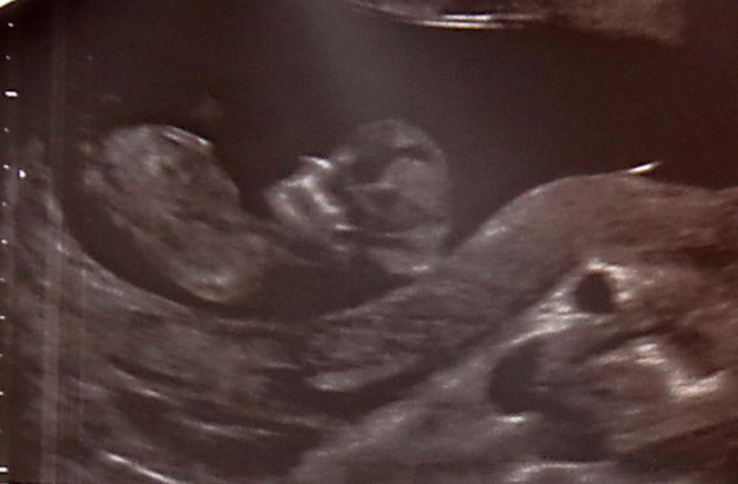 Przez lekarzy umarła mi córka, a teraz żona