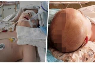 11-letni Kacper otarł się o śmierć. Mieszkaniec Piotrkowa Trybunalskiego jest już tylko otoczony miłością [ZDJĘCIA]