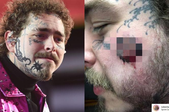 Post Malone ma nowy tatuaż na twarzy