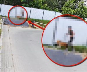 Pies pogryzł 9-latkę. Właścicielka uciekła [AKTUALIZACJA]