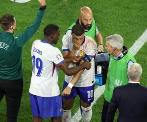 Kontuzja nosa Mbappe podczas Euro 2024