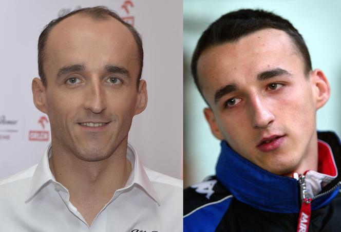 Jak zmieniali się sportowcy - Robert Kubica