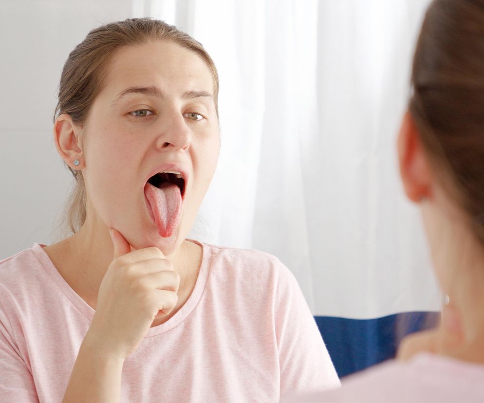 Kolor języka to ważny sygnał ostrzegawczy. Może świadczyć o chorobie serca
