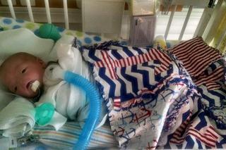 Mały Timothy urodził się bez nosa