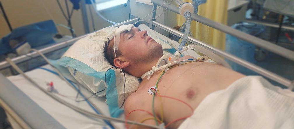 Michał miał straszny wypadek. Pomóżmy mu wrócić do zdrowia