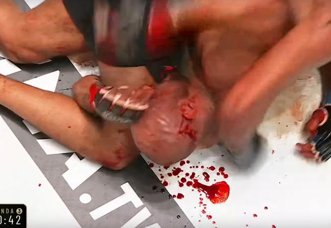 Krwawa rzeź w walce na PRIME MMA