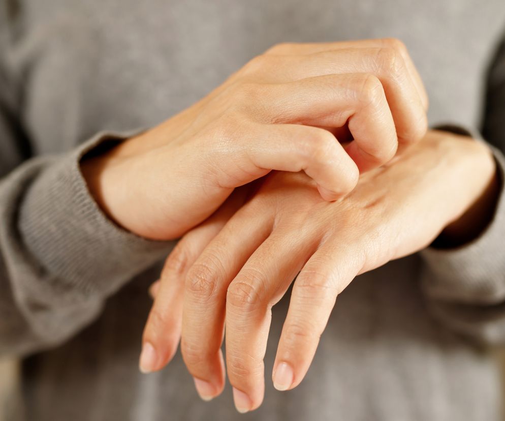 Gronkowiec skórny jest groźny dla określonej grupy osób, ale może powodować uciążliwe objawy 