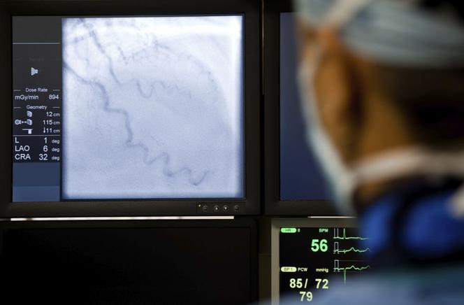 Angiografia nerkowa - badanie naczyniowe nerek