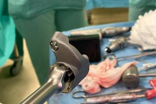Lekarze wstawili choremu tytanowy staw barkowy wydrukowany w 3D