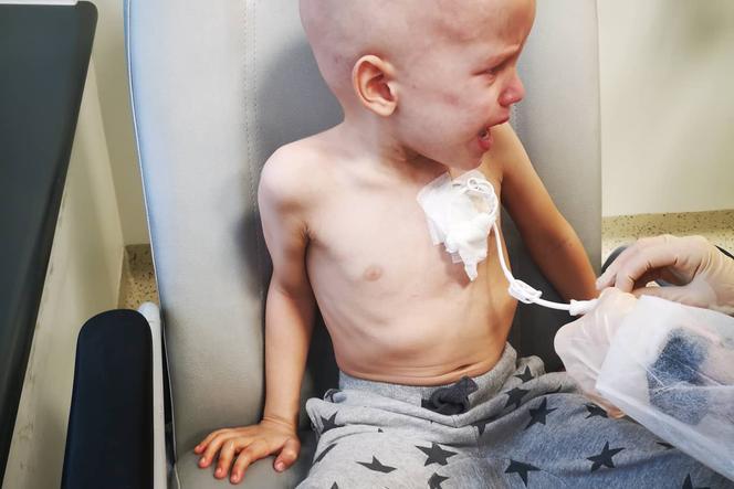 Mały Oluś choruje na neuroblastomę IV stopnia
