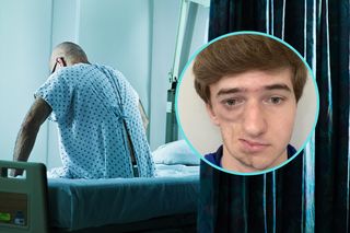 19-latek cierpi na rzadką chorobę. Połowa jego twarzy się stopiła