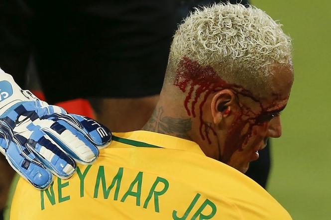 Neymar zalany krwią
