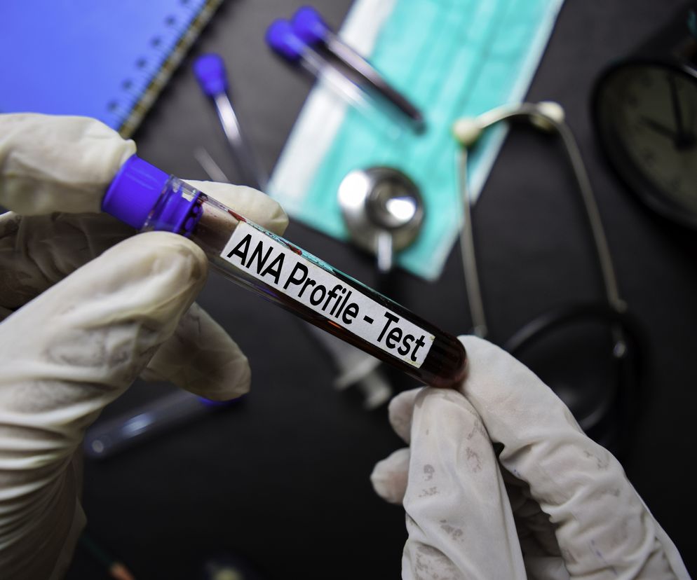 Test diagnostyczny ANA (przeciwciał przeciwjądrowych)