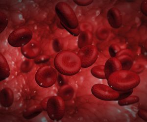 NADPŁYTKOWOŚĆ (trombocytoza, duża liczba płytek krwi) - przyczyny, objawy i leczenie