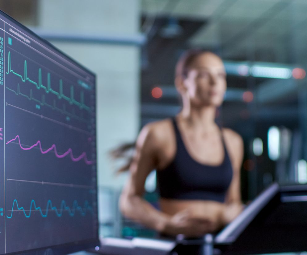 EKG wysiłkowe
