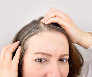Przetłuszczają się, siwieją i wypadają. Niedobór tej witaminy to duży problem dla włosów