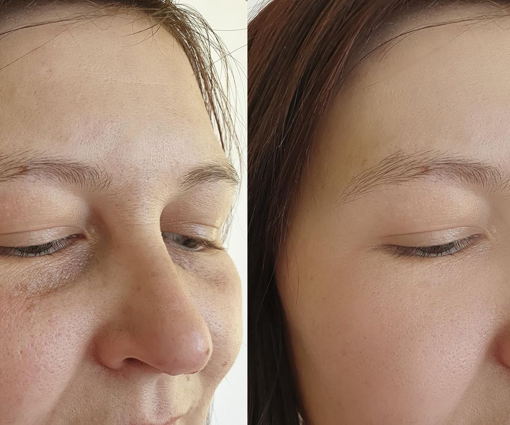 Działa jak zabieg u kosmetyczki, a kosztuje mniej niż kawa. Ta maść z apteki to prawdziwy hit wsród Polek