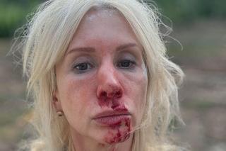 Ewa Gawryluk (Ewa z Pierwsza miłość) po wypadku na planie 