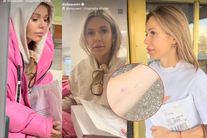 Doda pokazała bliznę po wycięciu czerniaka