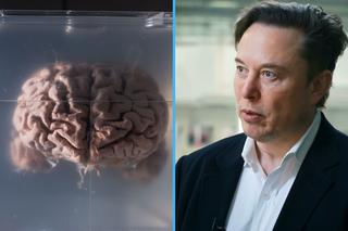 Firma Elona Muska będzie eksperymentować na ludziach. Jest zgoda na implanty mózgu