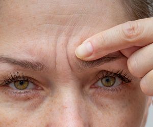 Odkryłam sprytny trik na lwią zmarszczkę. 5 minut wieczorem, a bruzda między brwiami zaczęła znikać