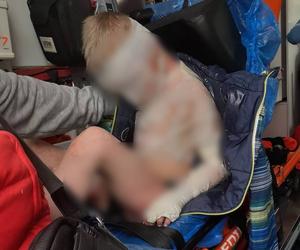 Ośmioletni Kamil z Częstochowy był katowany od tygodni