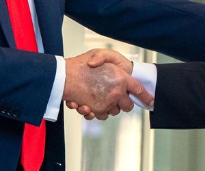 Donald Trump ma kłopoty ze zdrowiem. Nowe zdjęcia wywołały niepokój